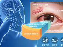 关于干眼，这篇文章都说清楚了！