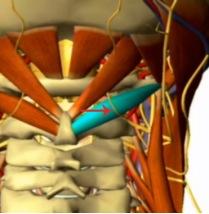 第2颈神经后支位于头下斜肌（箭头处）表面。  受访者供图