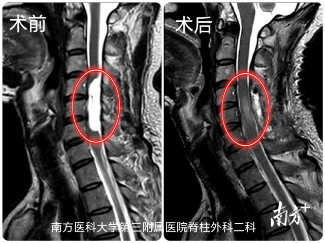 通讯员 南医三院 供图