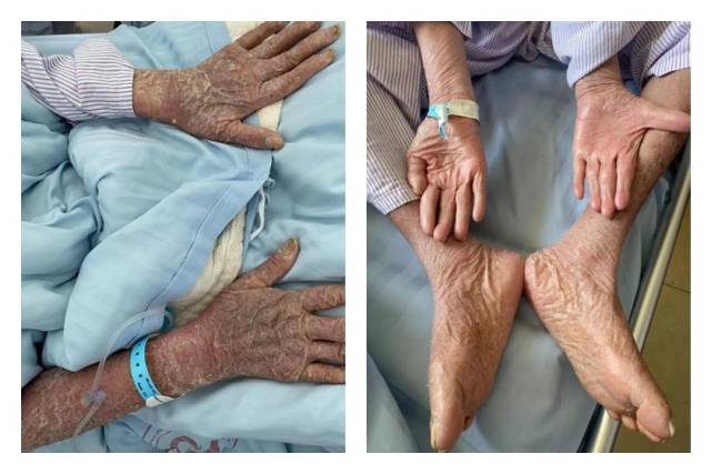 治疗前后对比。  受访者供图