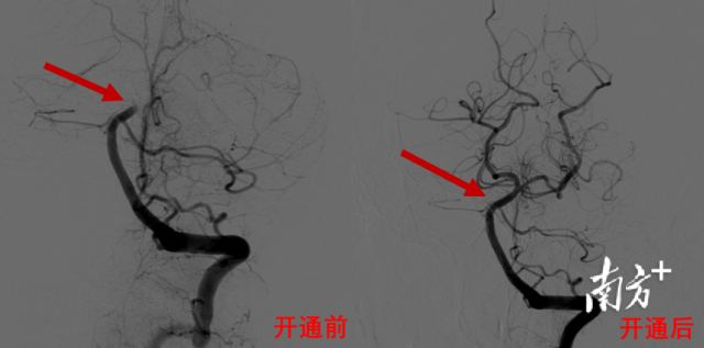 通讯员 二医 供图