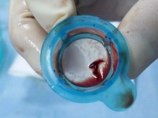 “救心”要快，牢记两个“120”