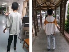 少年脑出血肢麻无力 ，中西医康复轻松走起