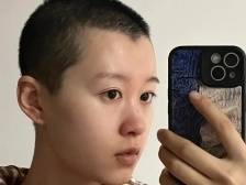 长发及腰到光头“小子”，我的发量焦虑消失了｜我的健康故事