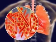 家长对肺炎支原体的疑问，这位儿科医生都解释清楚了｜健康深一度