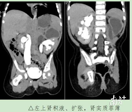 通讯员 二医 供图