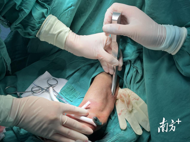 通讯员 省二医 供图