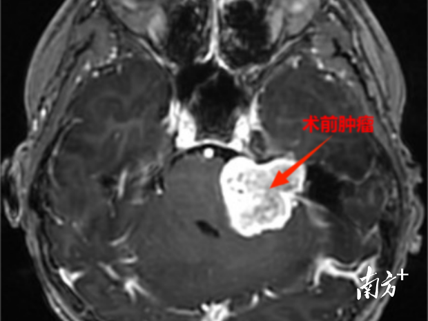 通讯员 第二医院 供图