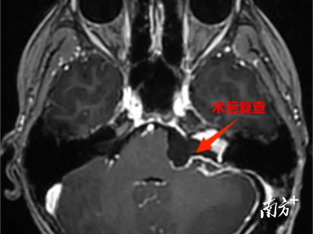 通讯员 第二医院 供图