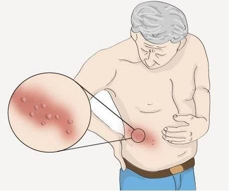 痛不欲生想跳楼！我们该如何远离这种疾病？｜健康深一度